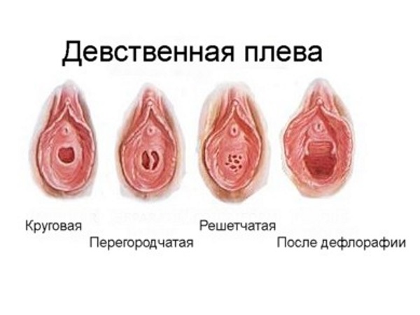 Девственная плева